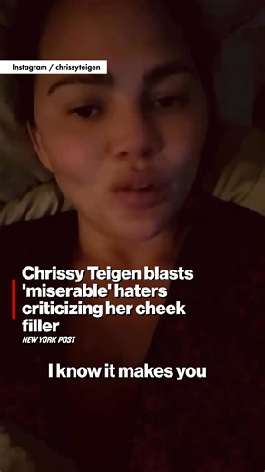 240K views · 862 reactions | She's clapping back.  Chrissy Teigen blasted “miserable” people who criticized the way her cheek filler looked in recent photos. | New York Post | Facebook