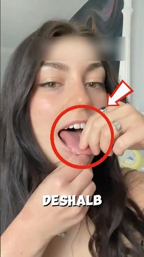 Tongue piercing: Risks to your teeth