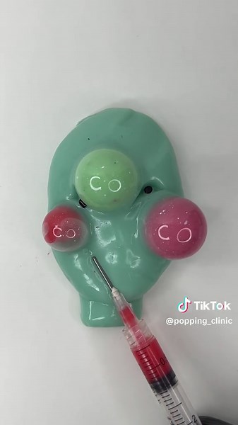 How to make pimples in DIY Face 😱 #pimplepopping #pimplepoppingasmr #tiktokasmr #foryoupage #oddlysatisfying