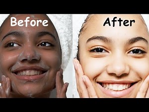 I got Amazing Skin Whitening at Home from this Korean Homemade Skin Whitening Cream instant glow