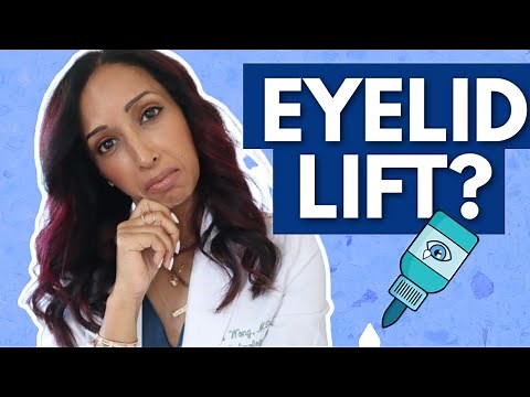 A Drop to Lift Eyelids? Eye Doctor Tries And Reviews Upneeq