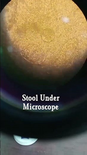 What is identify stool sample under Microscope #Stool found ova #Stool found under Larva # stool A.L