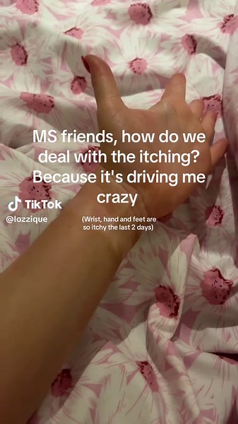 Managing Itching Symptoms of Multiple Sclerosis