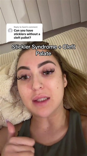 Stickler syndrome and cleft palate