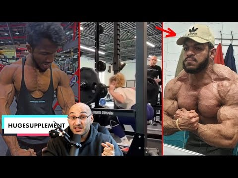 Roids Ruined his Physique
