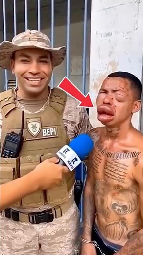 What happens if you get stung by a bee? 🐝