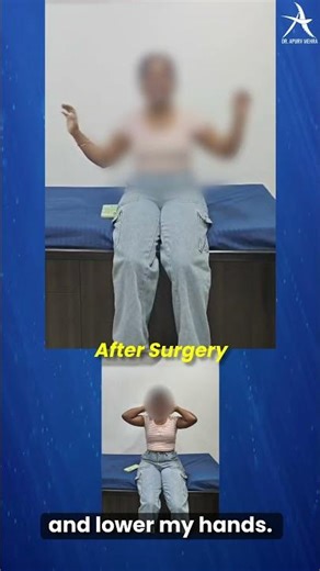 Humerus Shaft Fracture Recovery | Shoulder Movement Restored at Vidya Jeevan Orthopedic Centre