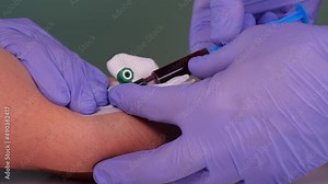 Blood donation concept. Injection for blood collection. Nurse or paramedic prepares the patient for blood donation. Blood test preparation.