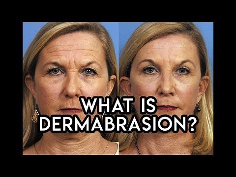 Dermabrasion