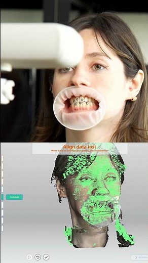 Dentulous Motion Module | MetiSmile MR