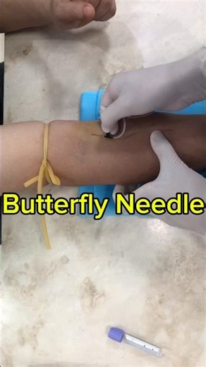 Butterfly Needle