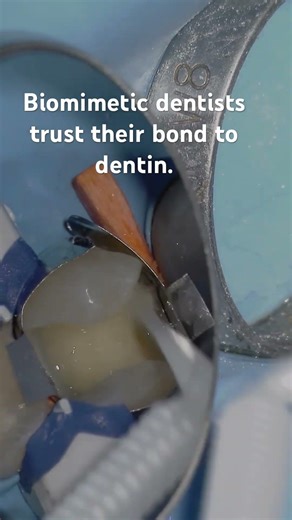 Predictable Dentin Bonding Techniques