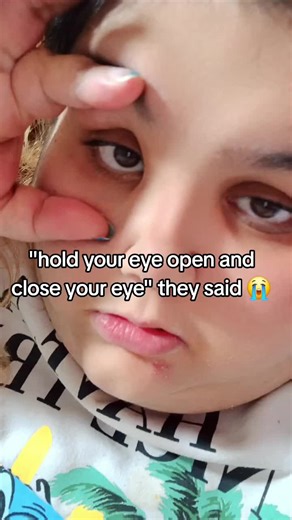 Understanding Eye Movement Issues and Remedies