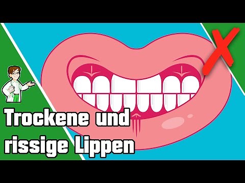 4 Gründe für trockene und rissige Lippen 👄