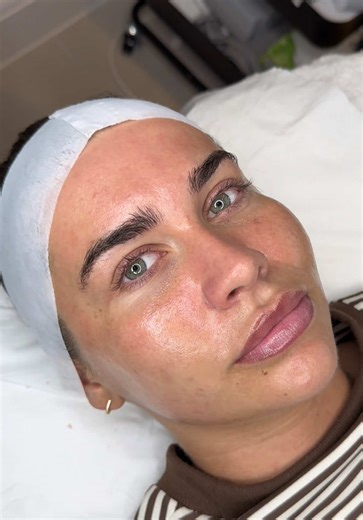 Ultimate Facial Treatment for Healthy Skin: Step-by-Step Guide