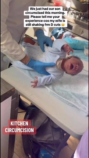4.6K views · 43 reactions | KITCHEN CIRCUMCISION OF NEWBORN BOY. The video begins just after the baby's foreskin membrane has been ripped loose from the head of his penis, the pain causing him to shriek and fall unconscious while the #circumcision salesman and his assistant in white shirts collect $257 in advance. | Brother K | Facebook