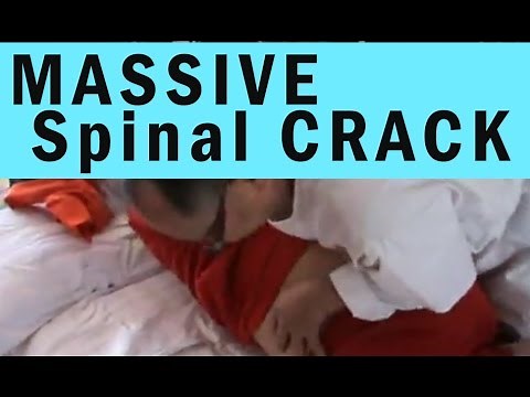 MASSIVE Back crack - Chinese Spinal adjustment