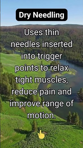 How does dry needling work?