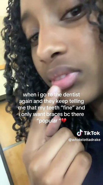 my teeth literally FLARE OUT #teeth #braces #dentist #overbite | teeth