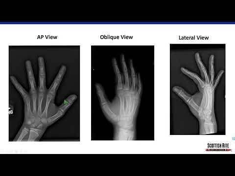 Pediatric Musculoskeletal Radiology Imaging and Interpretation Pearls and Pitfalls