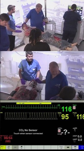 Anaesthetics Simulation – Burns Airway Emergency with Front of Neck Access FONA 1