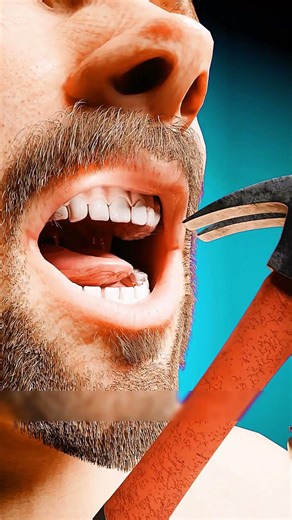 Fixing A Chipped Tooth In Seconds! 😱