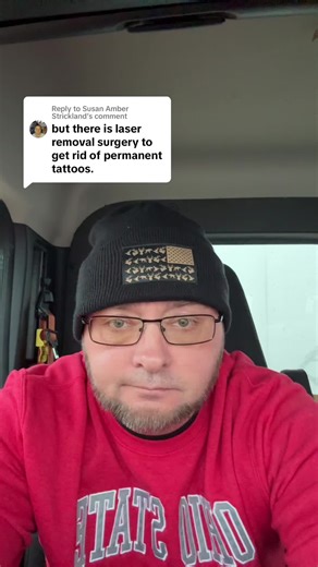 Effective Tattoo Removal Methods: What You Need to Know