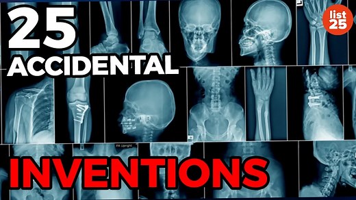 25 Accidental Inventions That Changed The World