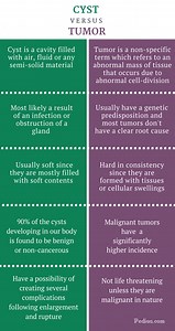 How do you tell the difference between a tumor and a cyst? [2025] | QAQooking.wiki