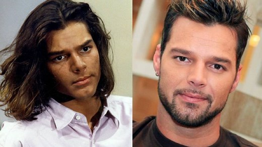 El antes y después de Ricky Martin: qué cirugías se hizo el cantante