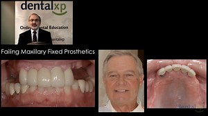 Interface Development and the Role of Prosthetic Artificial Gingiva PART 2 OF 4 - David Garber DMD