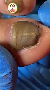 10K views · 125 reactions | Ep.702 Restaurant portion control and calorie awareness tips 殺 #CalorieControl #HeartHealthyDiet #SmartEating | Banda Verde | Facebook