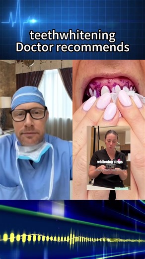 V34 Whitening Strips: Instant Teeth Whitening Revealed