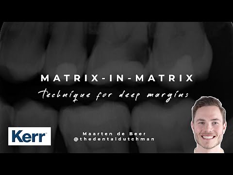 Deep Margin Elevation Made Simple | Matrix-in-Matrix Technique Tutorial