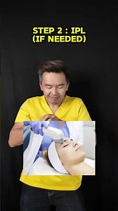 How to fade sun spots
