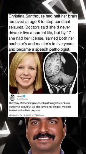 She had half her brain removed at age 8
