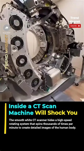 This Is What a CT Machine Really Looks Like