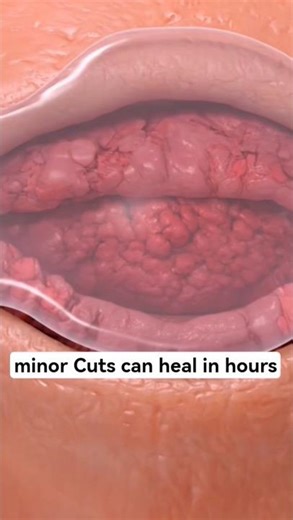 WHY DO SOME SCARS LAST FOREVER ? | Science Behind Skin Healing