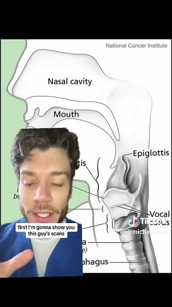 Why You Should Never Hold In a Sneeze: Doctor's Advice