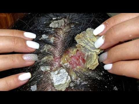 Hair Brushing & Scalp Scratching ASMR #S0063