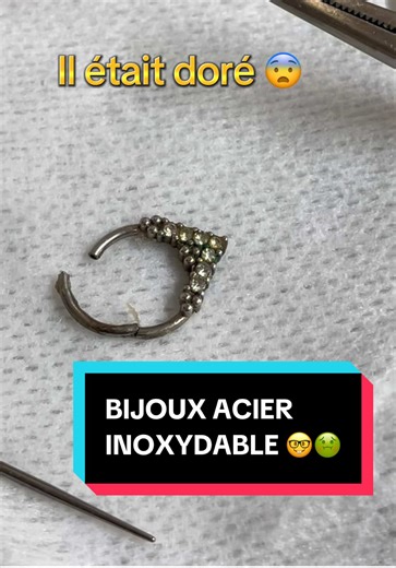 Sauvetage d'un Piercing Daith : Choix Crucial de Matériaux