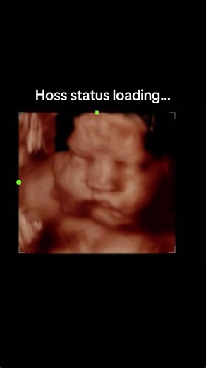 We do like ‘em chunky ‘round here! 🤭👶🏻 The ultrasound tech in me lovessss to see some cheeks like this! 🤣👏🏼