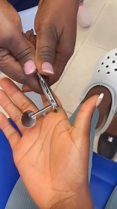 10M views · 7.1K reactions | Woman gets ring stuck on her finger and has to get it cut off! This is my nightmare! This is an original BVIRAL/BestVideos content production. | Best Videos | Facebook