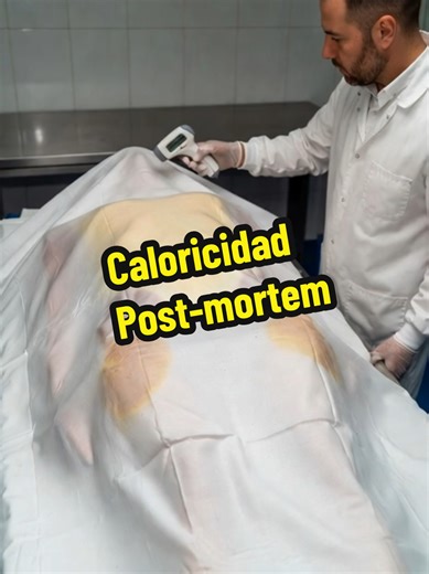 🚨 “¿Sabías que un cuerpo puede AUMENTAR su temperatura… después de morir?” Sí. Aunque muchos creen que el cuerpo se enfría de inmediato, existe algo llamado caloricidad post-mortem. Cuando una persona fallece, lo normal es que comience el algor mortis (el enfriamiento progresivo). Pero en algunos casos… ocurre lo contrario. 🔥 El cuerpo puede mantenerse caliente o incluso subir ligeramente su temperatura si antes hubo: Fiebre muy alta Sepsis o infección grave Golpe de calor Convulsiones prolong