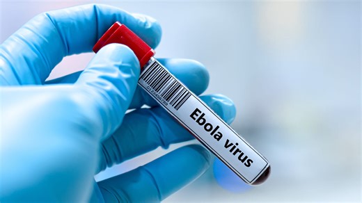 What is Ebola? CDC warns of virus outbreak. Risk low in Florida, US but possible