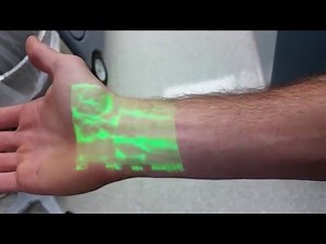 Vein finder test