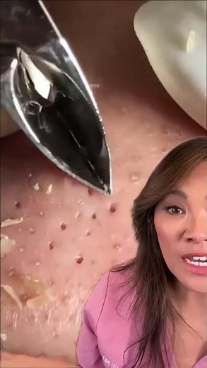 Can You Guess What’s Coming Out of These Pores?