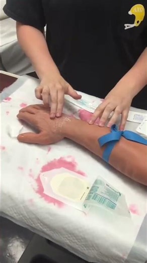 #ivinsertion #doctors #science #health #education