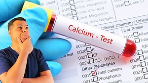 Hypocalcemia: Interpretation and treatment