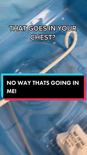 Pigtail Chest Tube Insertion and Removal Explained